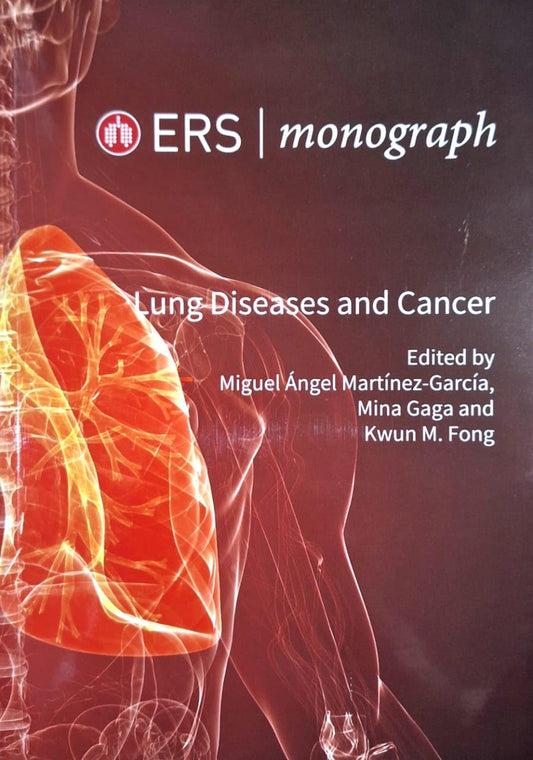 ERS MONOGRAPH LUNG DISEASES AND CANCER 1ST/2019 - MIGUEL ANGEL
